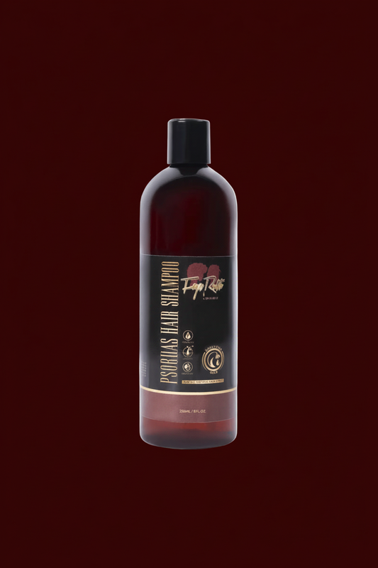 Psoriasis Shampoo - Faye Ruth